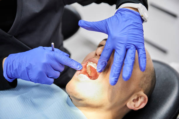Best Emergency Dental Care for Broken or Chipped Teeth in Cornersville, TN